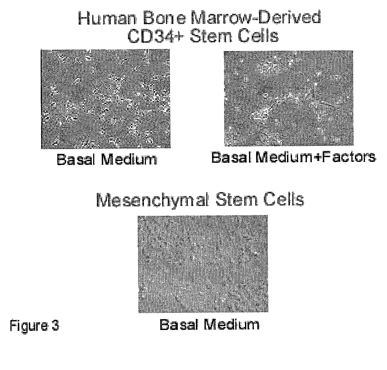 Method for transdifferentiation of non-pancreatic stem cells to the pancreatic differentiation pathway