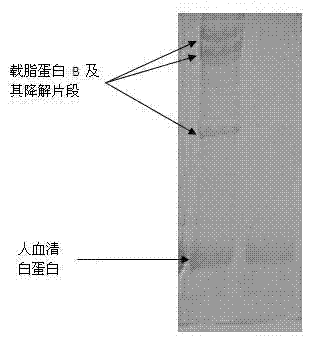 Rapid purification method of apolipoprotein B