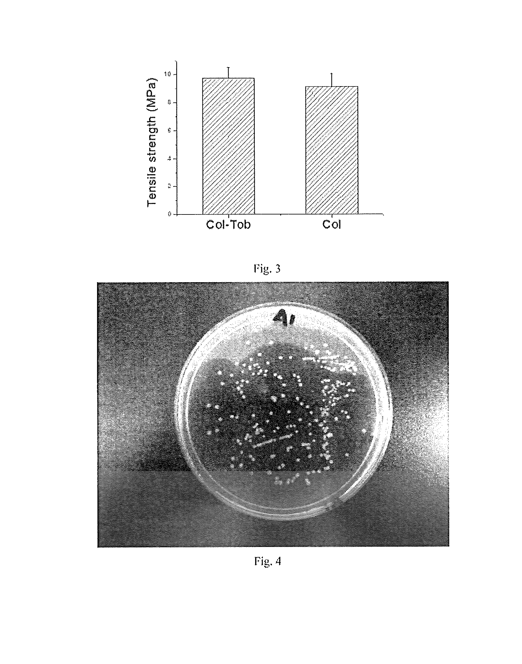 Antibacterial cornea repair material and preparation method thereof