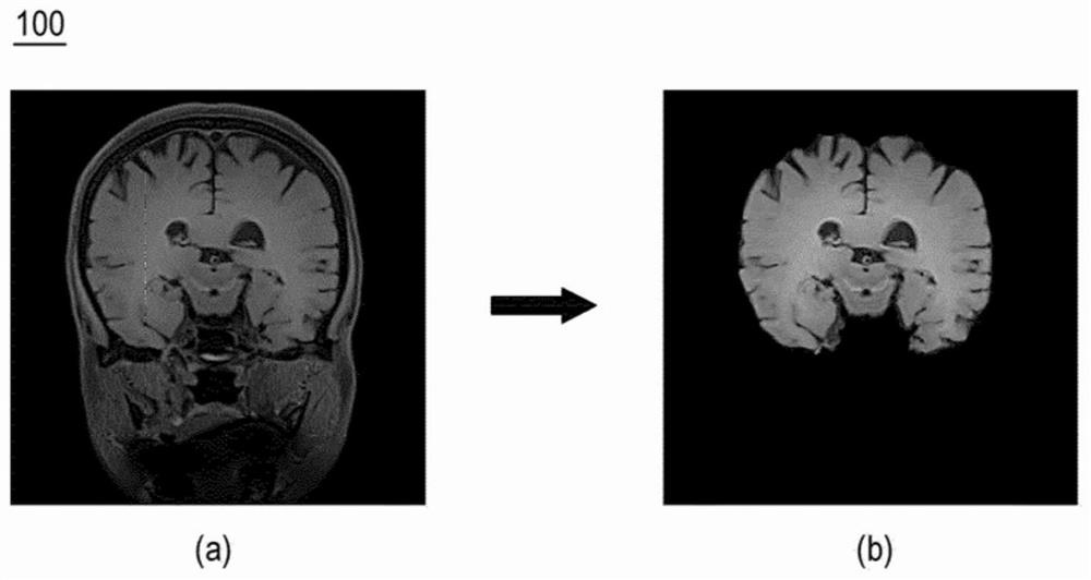 Device and system for providing Parkinson's disease information using neuromelanin image