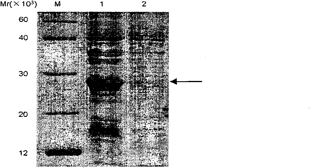 IgY antibody for resisting botulinus toxin substrate peptide SubA as well as preparation method and application thereof