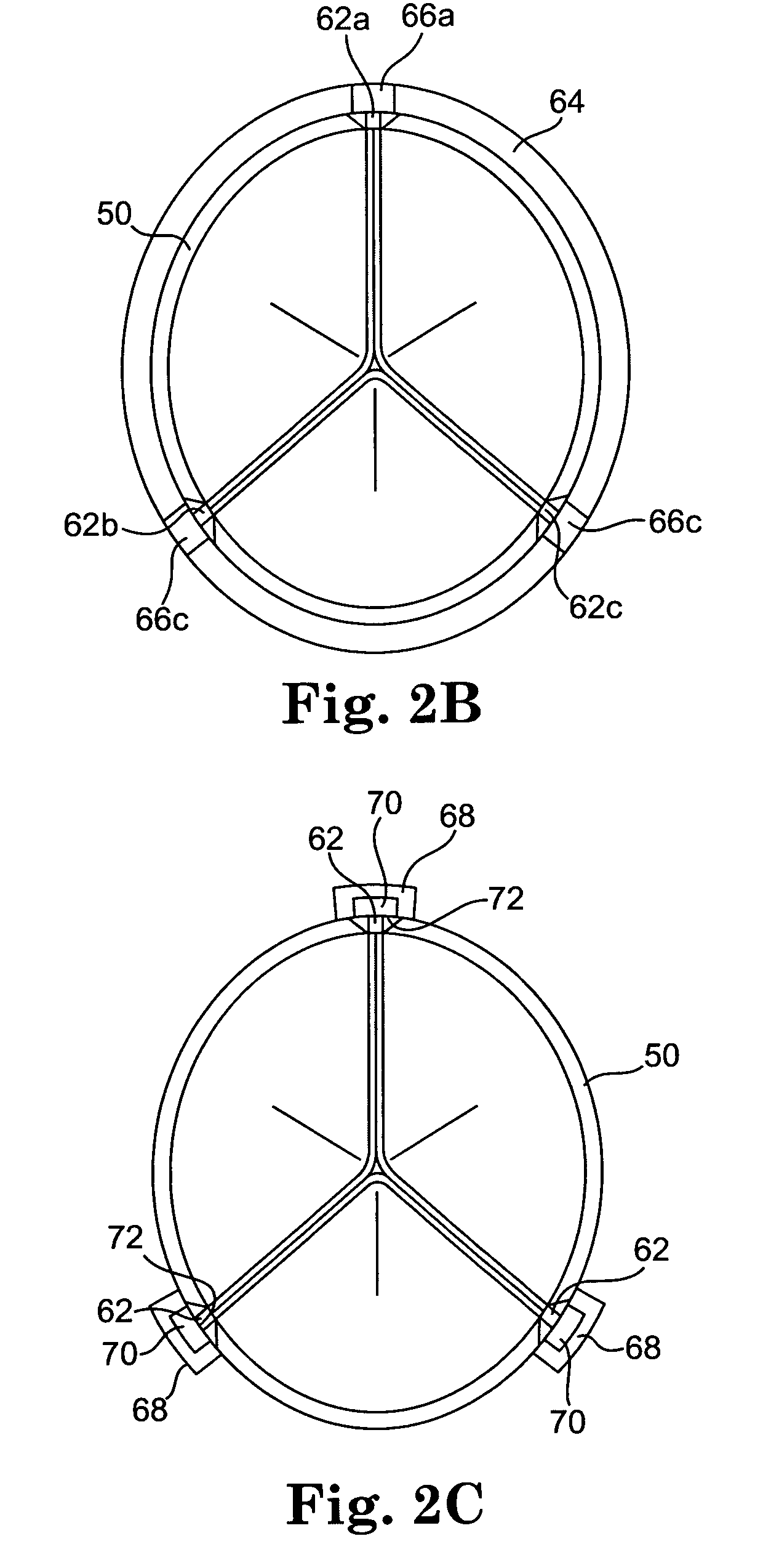 Prosthetic cardiac valves and systems and methods for implanting thereof