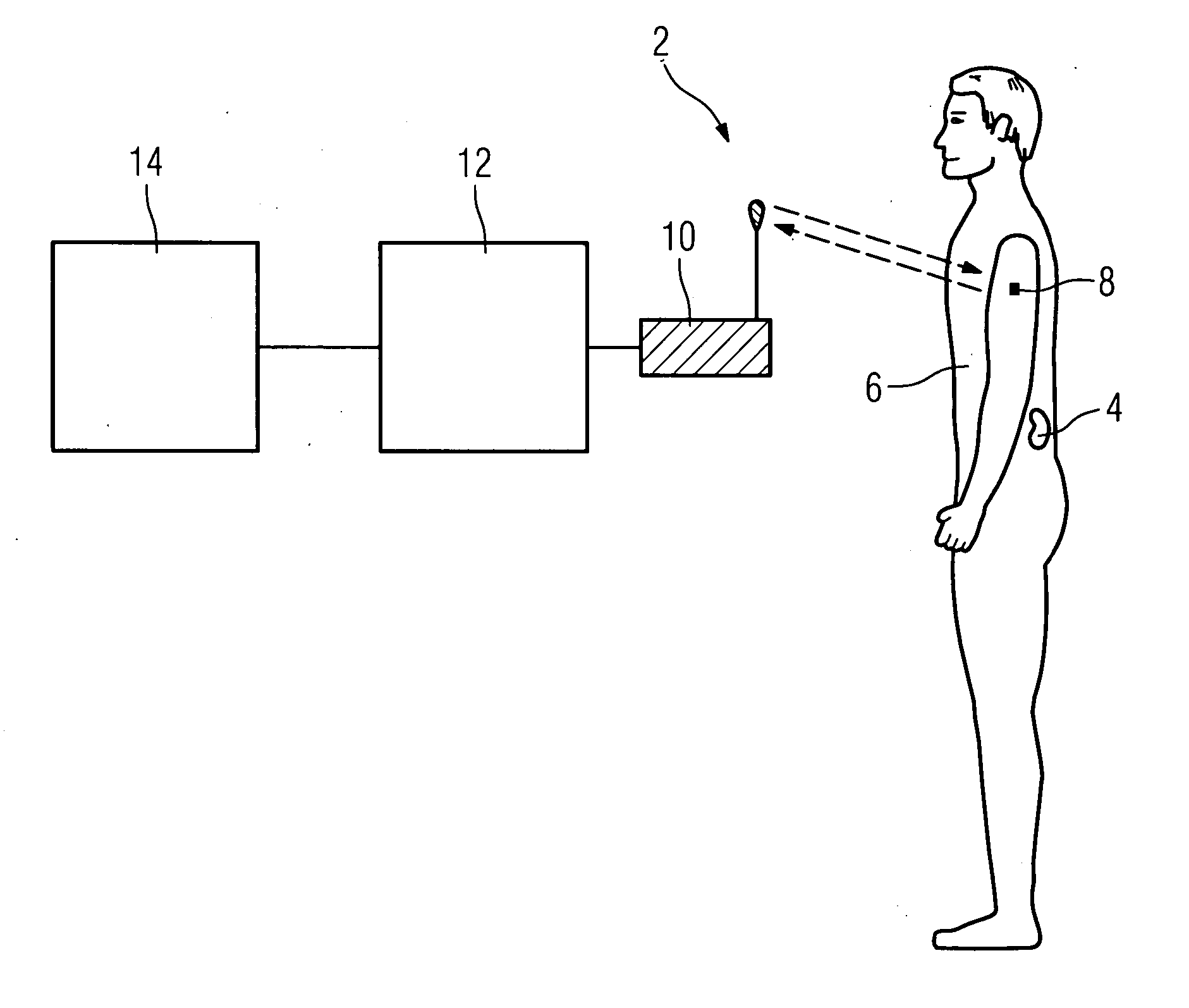 Method and system for identification of a medical implant