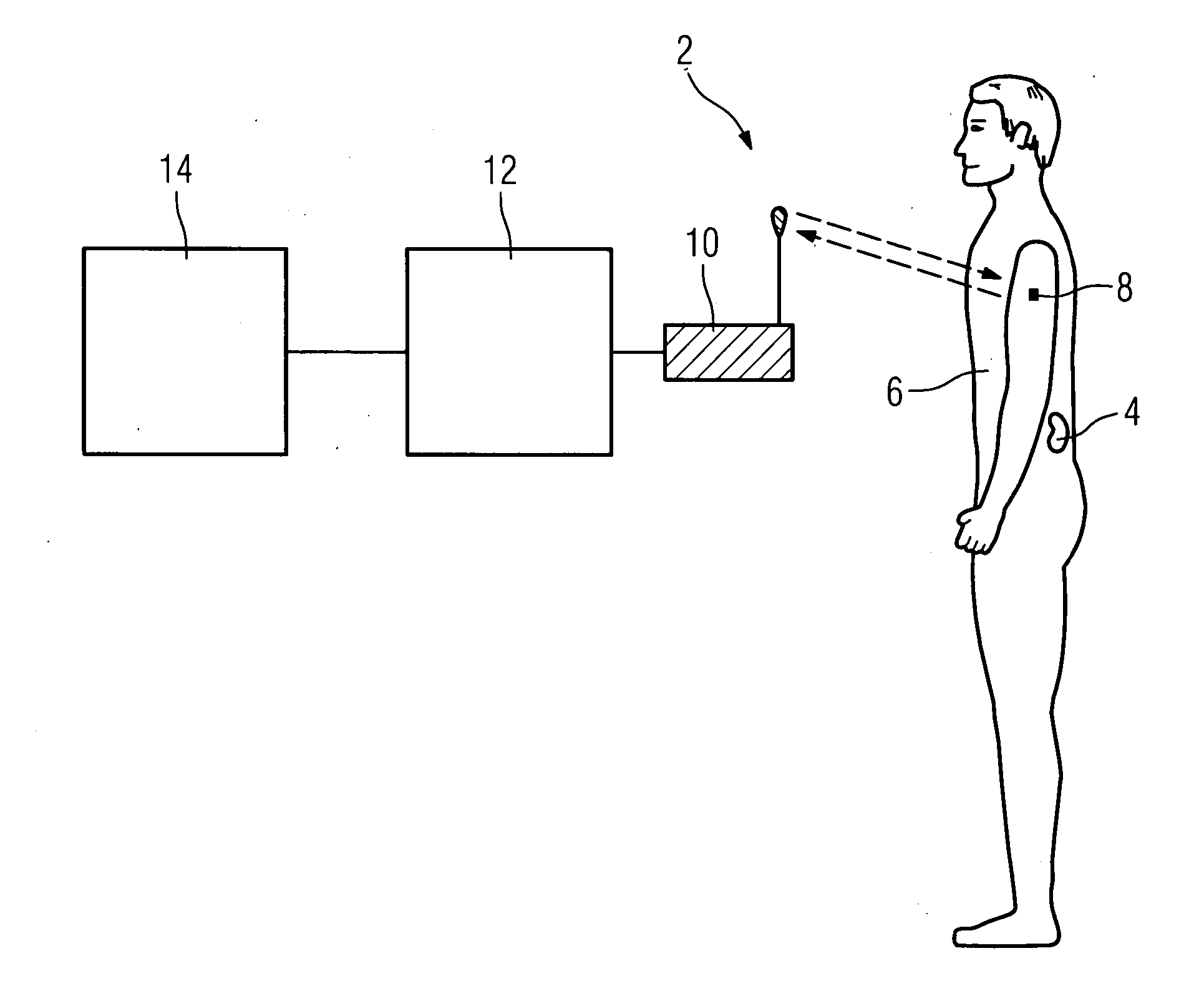 Method and system for identification of a medical implant