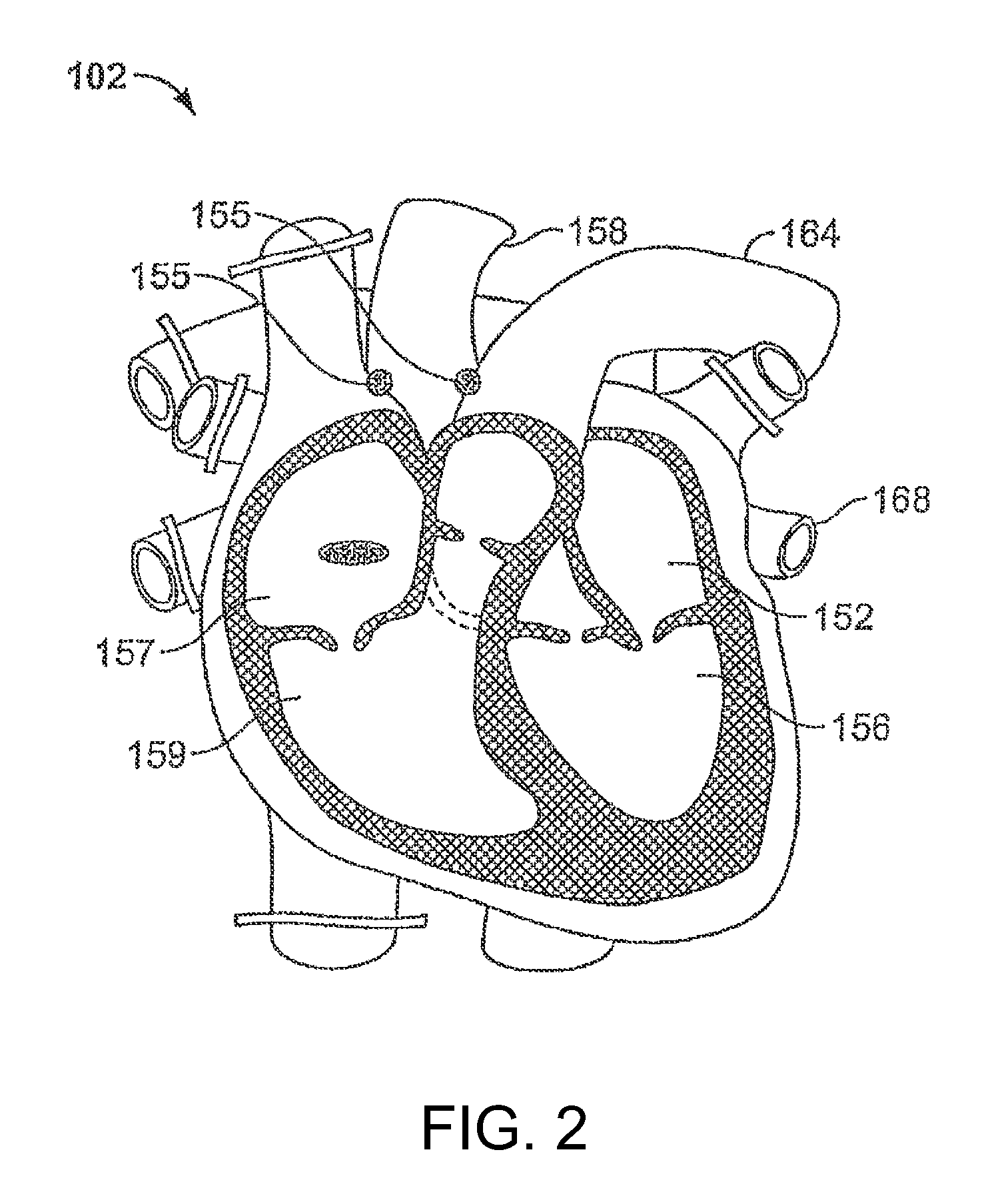 Systems and Methods for Ex Vivo Organ Care