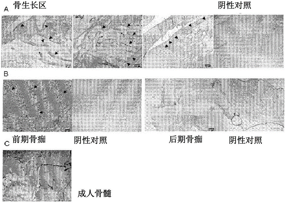 Use of hla-g subtypes as markers of osteogenesis