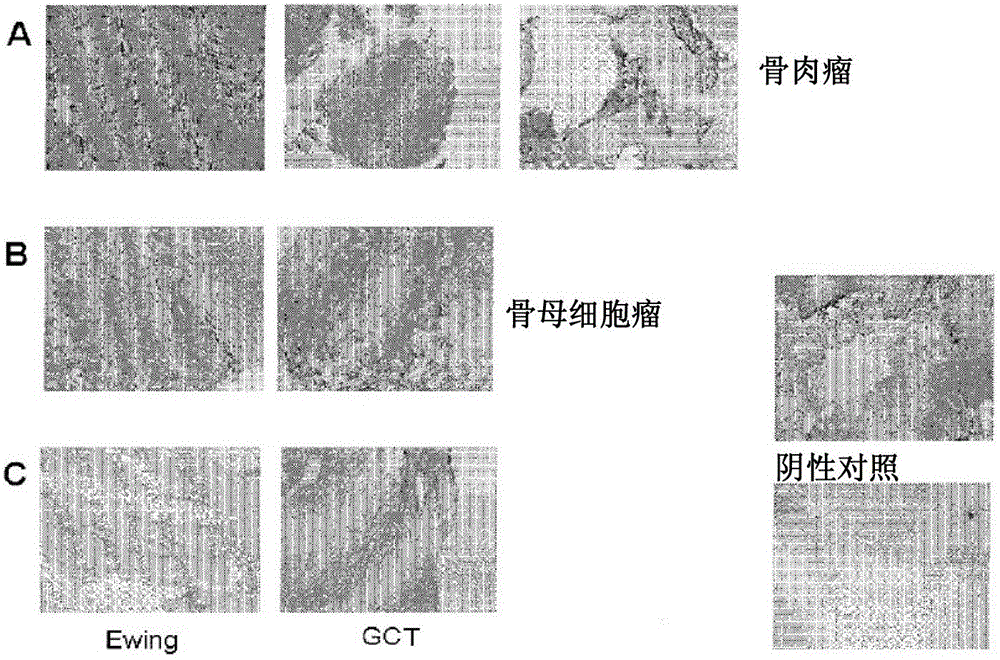 Use of hla-g subtypes as markers of osteogenesis