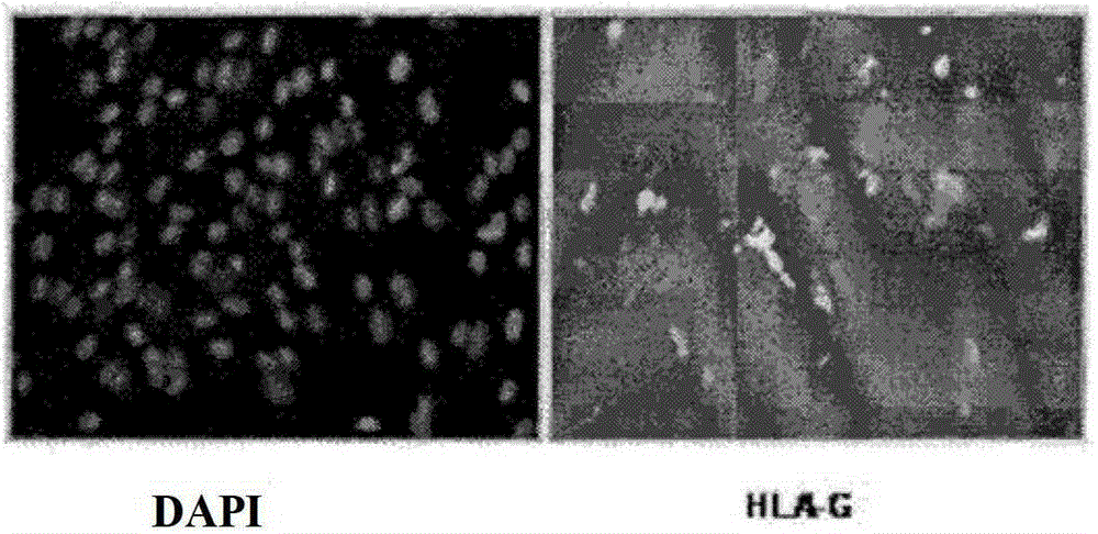 Use of hla-g subtypes as markers of osteogenesis