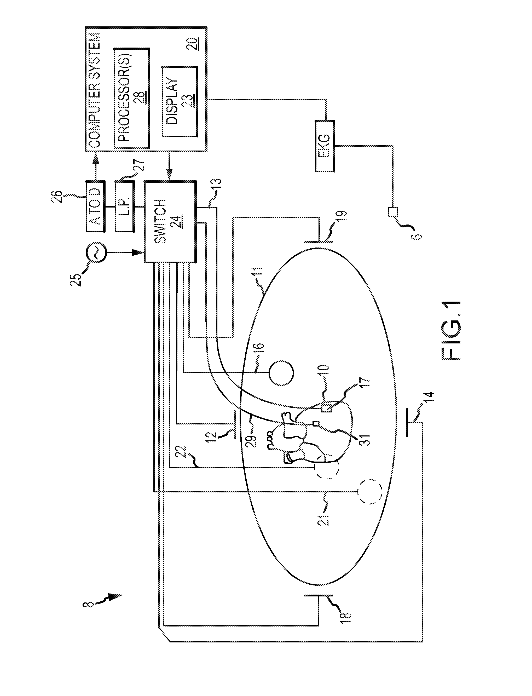 Methods and systems for mapping local conduction velocity