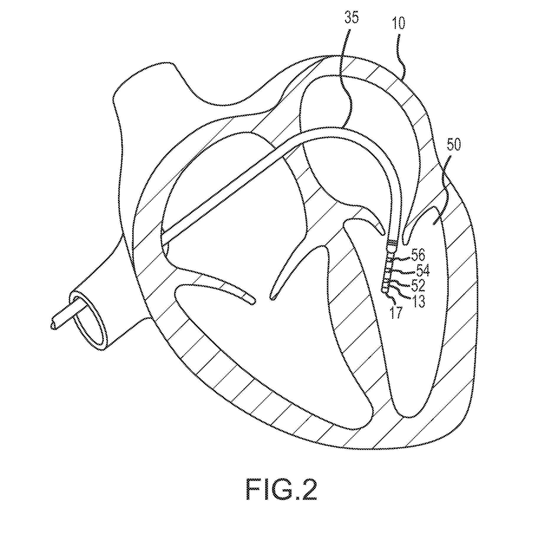 Methods and systems for mapping local conduction velocity