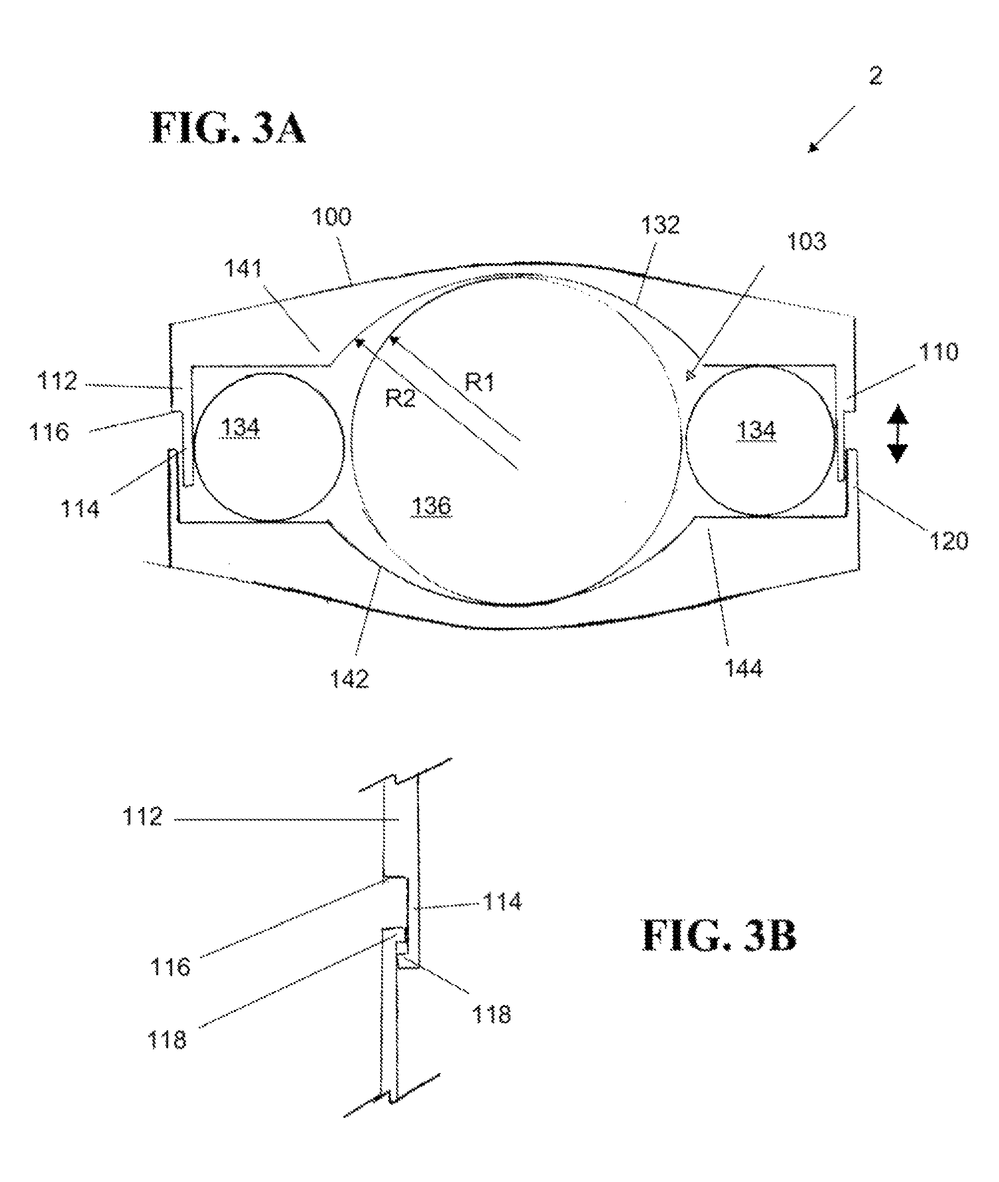 Artificial disc prosthesis for replacing a damaged nucleus