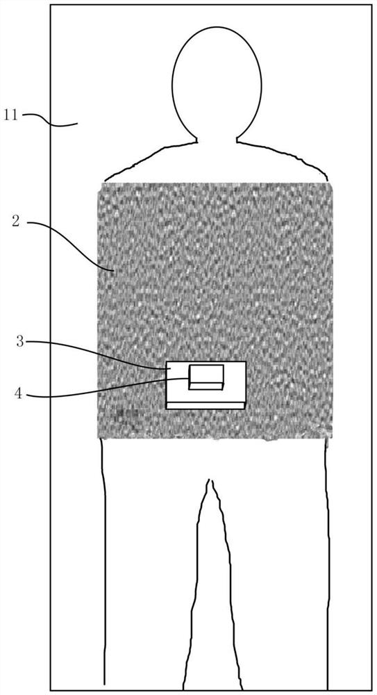 Tumor and organ position ultrasonic image real-time monitoring system for radiotherapy