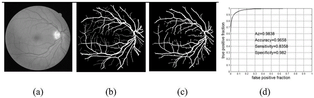 Retinal vessel segmentation method of fundus image based on classification and regression tree and AdaBoost
