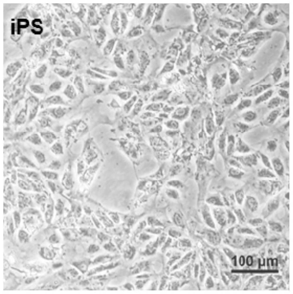 Synthetic modified Olig2 mRNA and application thereof