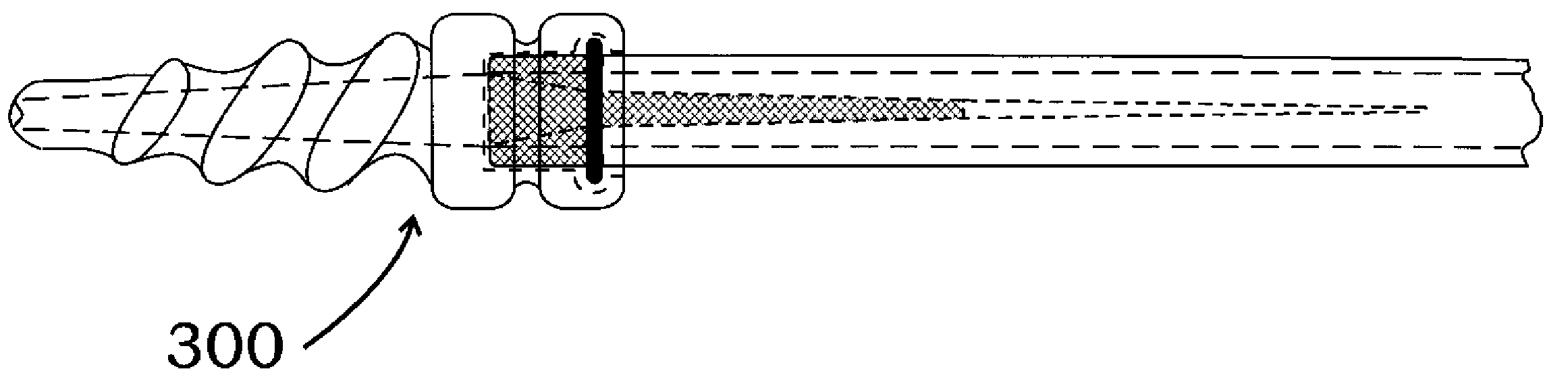 Method and apparatus for creating a pathway in an animal