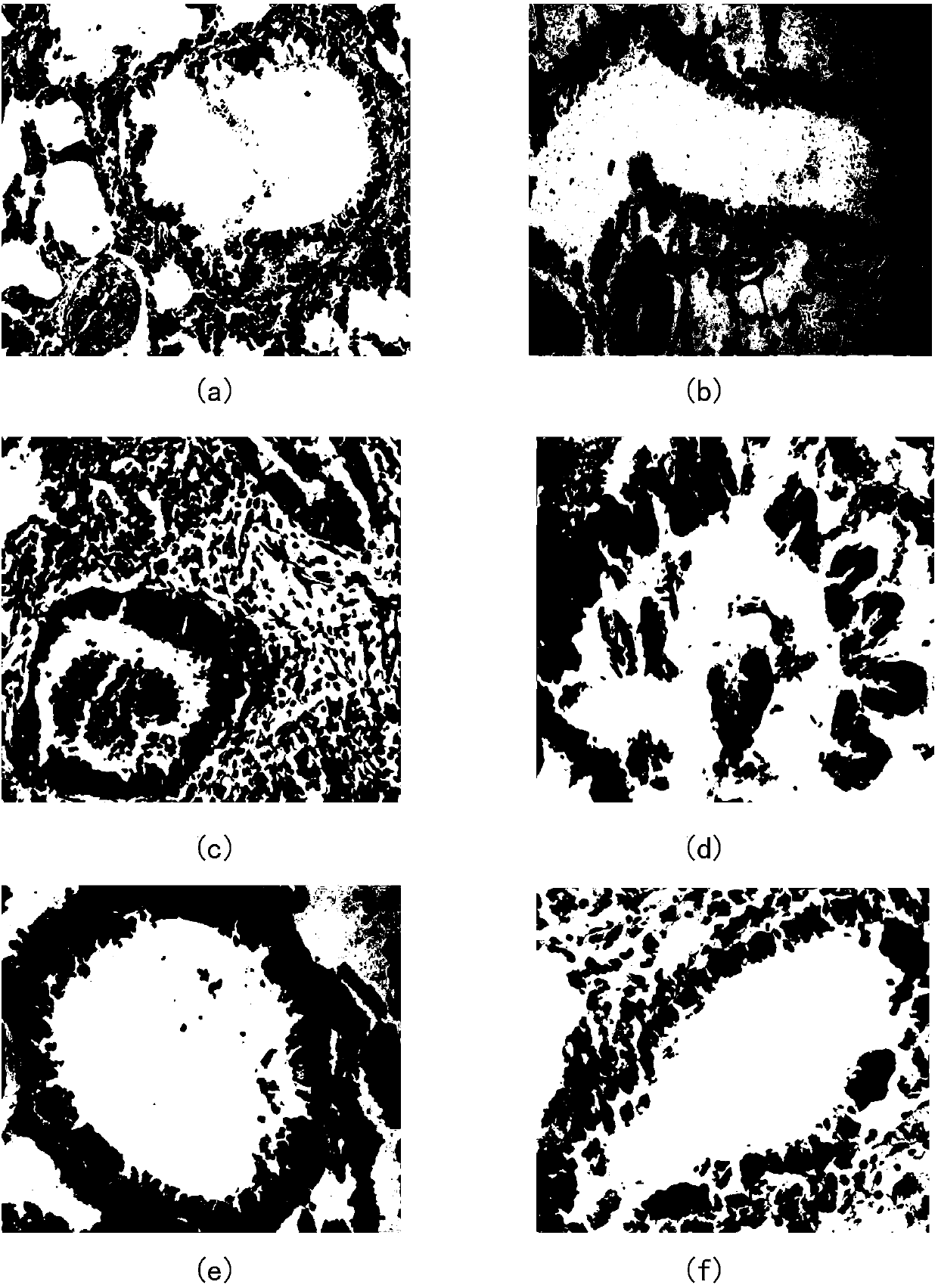 Rat model with symptom of cold fluid retention in lung of bronchial asthma and construction method of rat model
