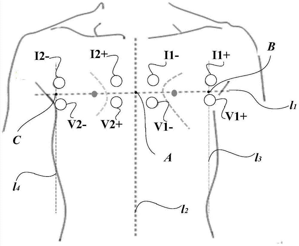 An Impedance Lung Volume Measurement Method Based on Information Fusion