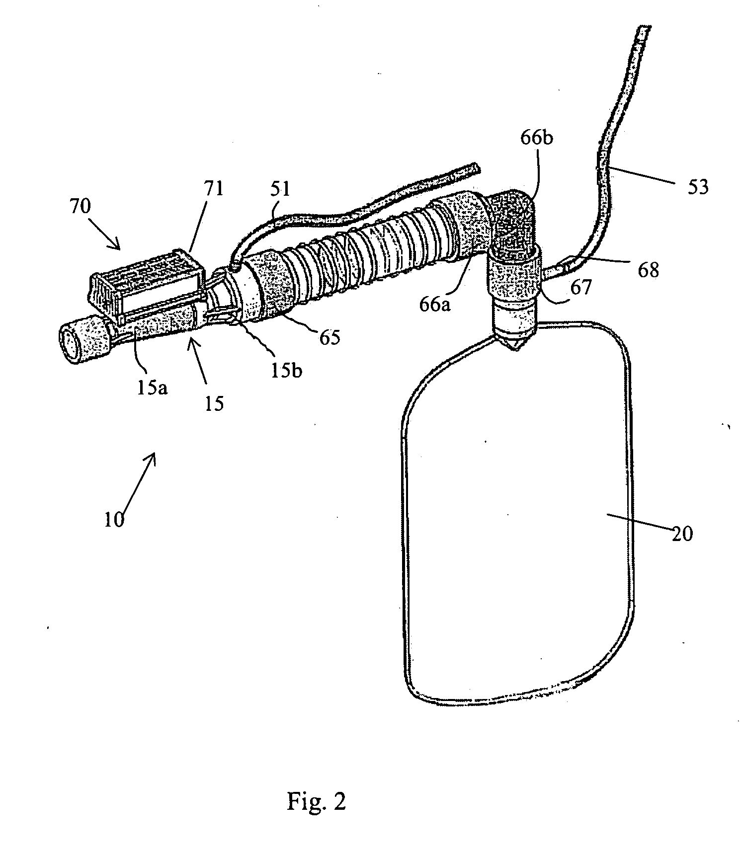 Medical device for a patient's ventilatory support