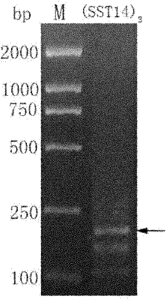 Fusion protein of human somatostatin tetradecapeptide and human serum albumin, and coding gene and preparation method thereof