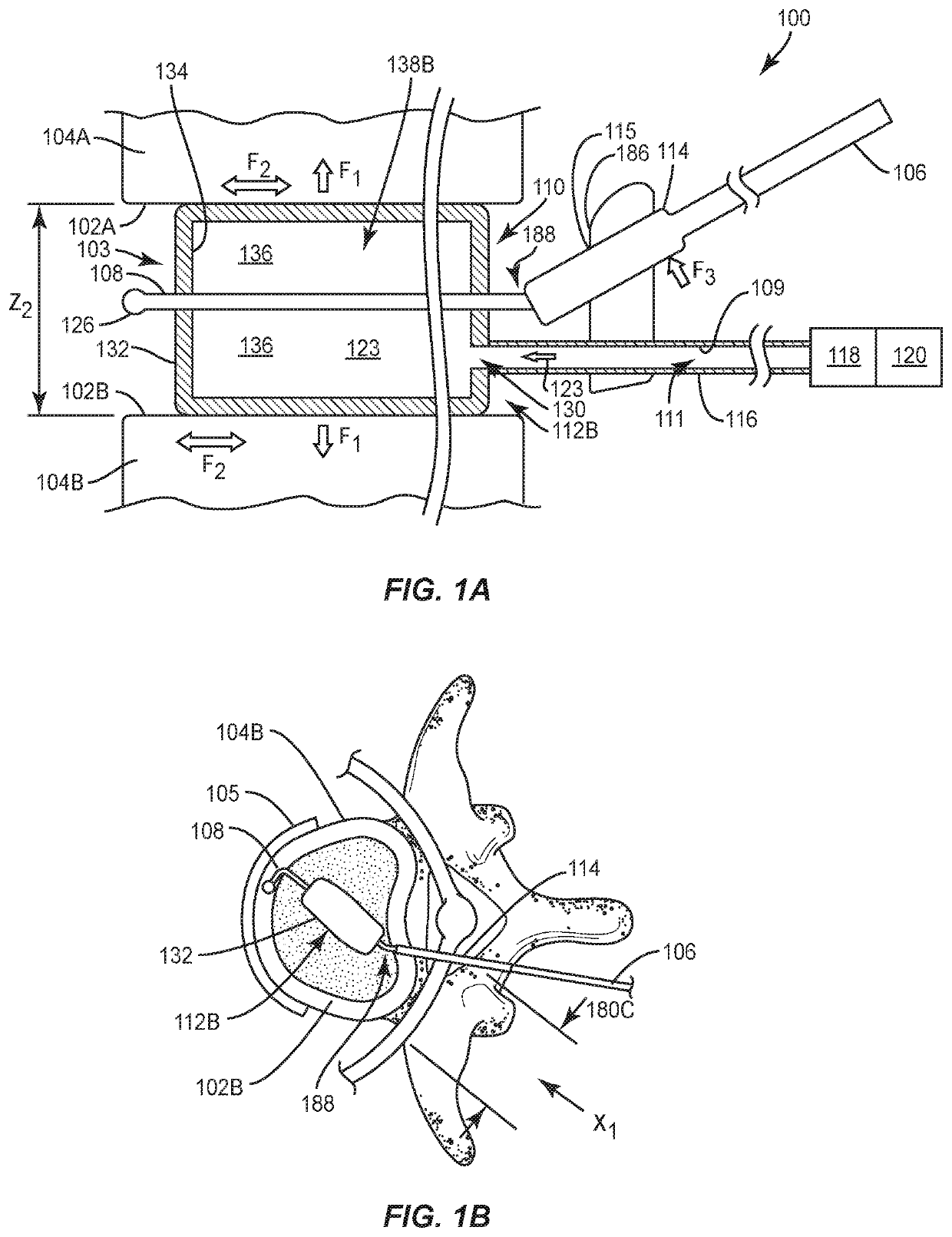 Intervertebral inflatable distractors employing thecal sac retractors, and related systems and methods