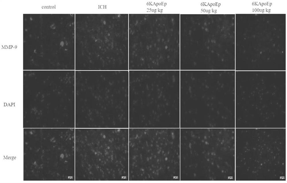 Application of apolipoprotein E receptor mimetic peptide 6KApoEp in preparation of medicine for treating secondary brain injury after cerebral hemorrhage