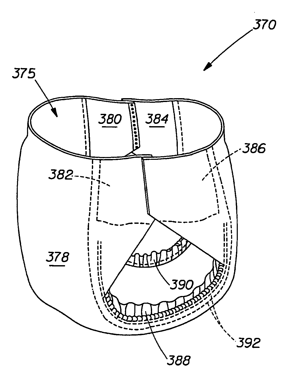 Disposable absorbent articles with zones comprising elastomeric components