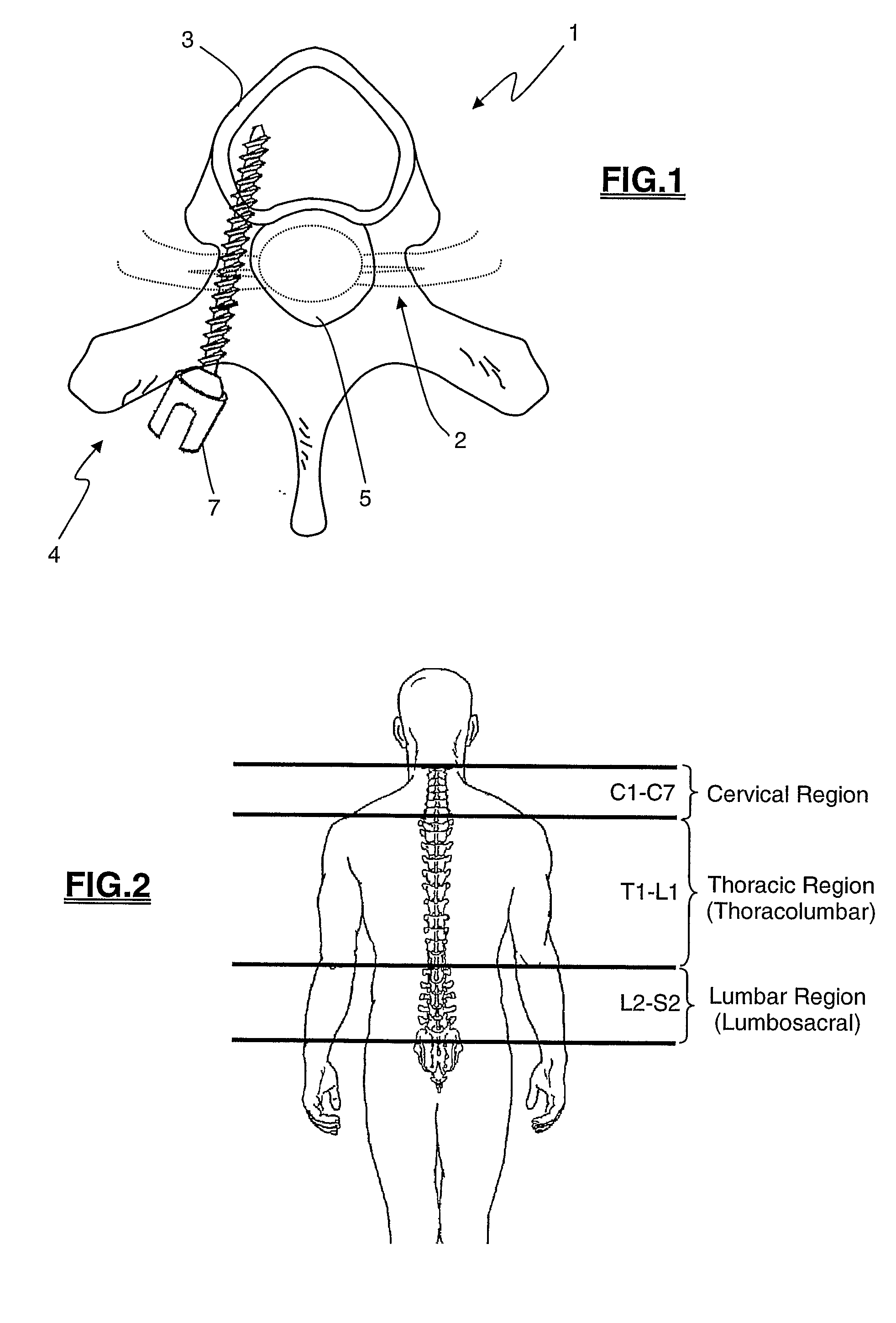 System and Methods for Performing Pedicle Integrity Assessments of the Thoracic Spine