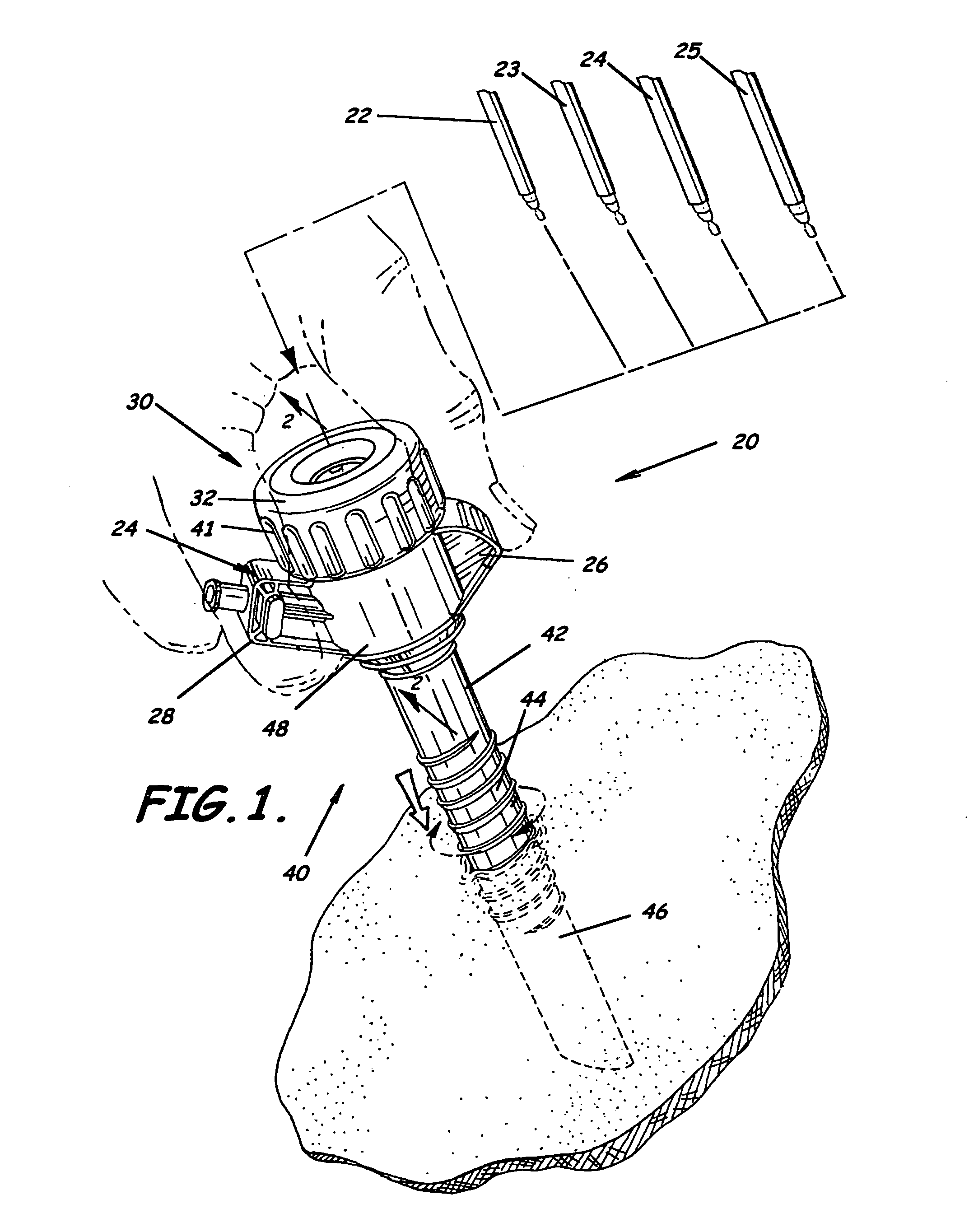 Trocar having planar fixed septum seal and related methods