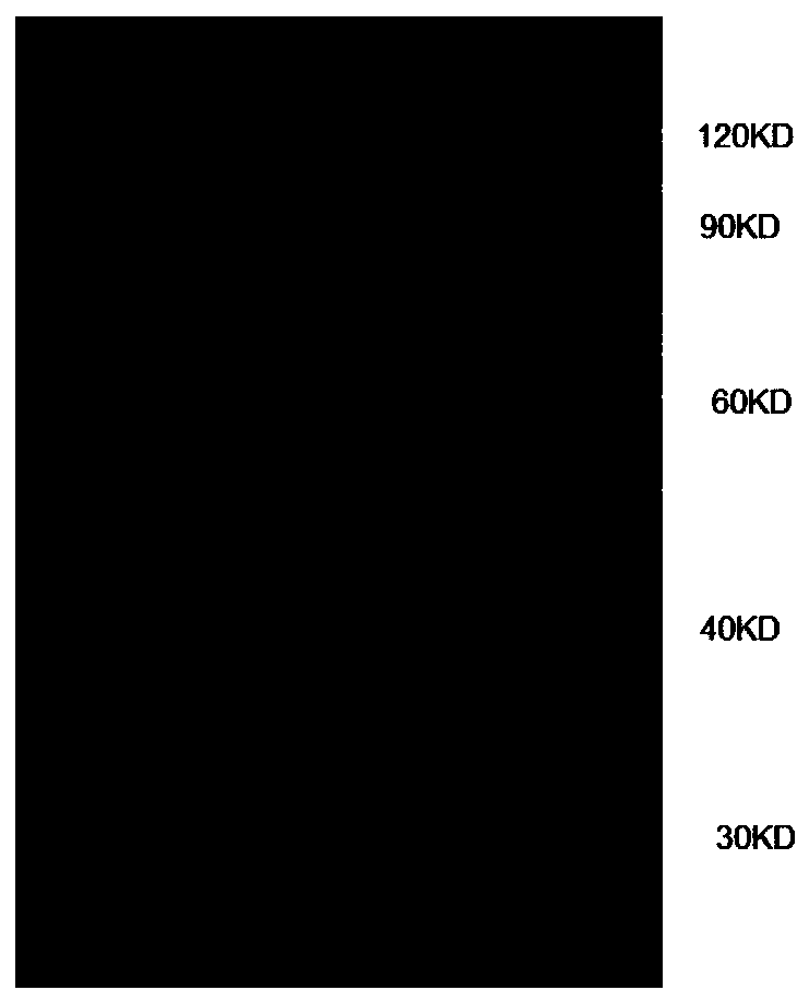 Signal regulatory protein alpha fragment-anti-FcRn single-chain antibody fusion protein as well as preparation and application thereof