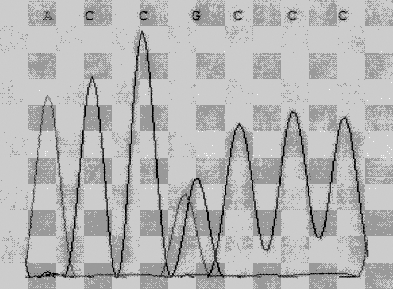 Single nucleotide polymorphism (SNP) of ADD1 gene of cattle and detection method thereof