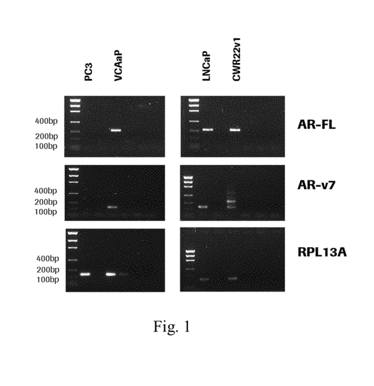 Materials and methods for detecting androgen receptor splice variants and uses thereof