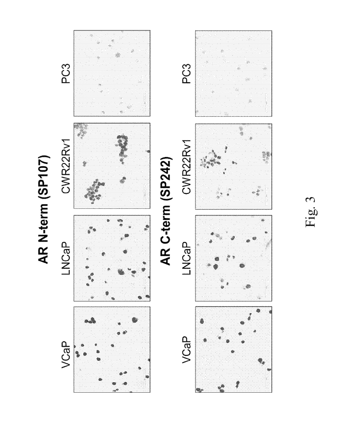 Materials and methods for detecting androgen receptor splice variants and uses thereof