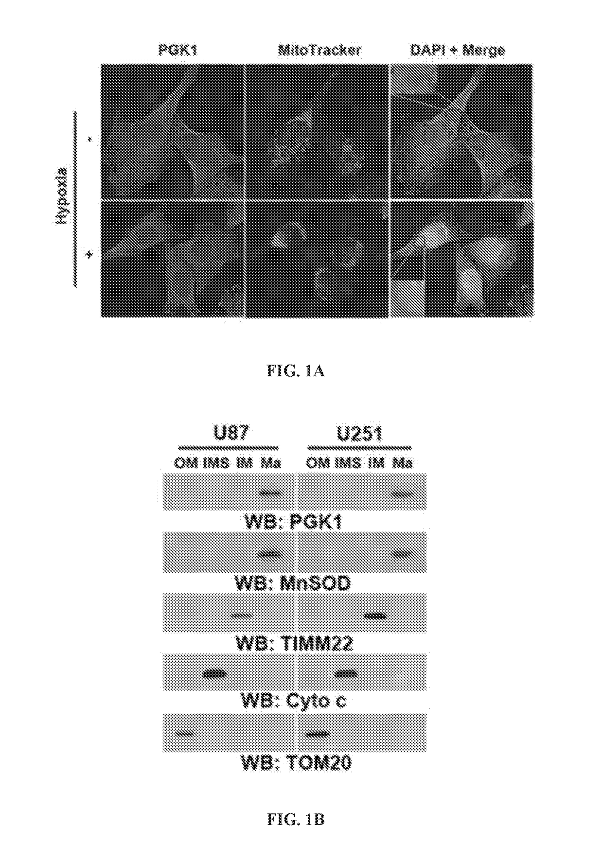 The protein kinase activity of phosphoglycerate kinase 1 as a target for cancer treatment and diagnosis