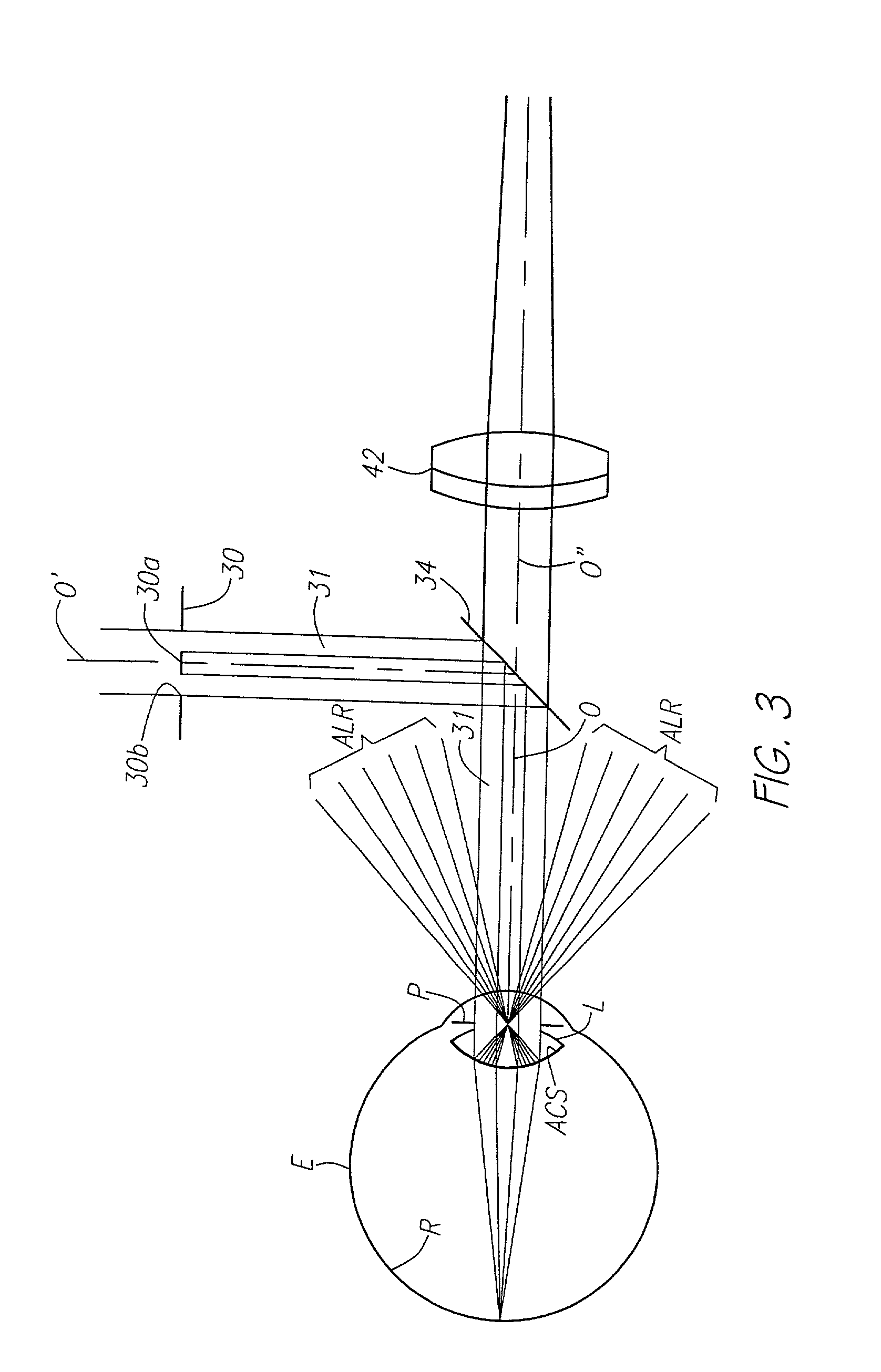 Method and apparatus for measuring optical aberrations of the human eye