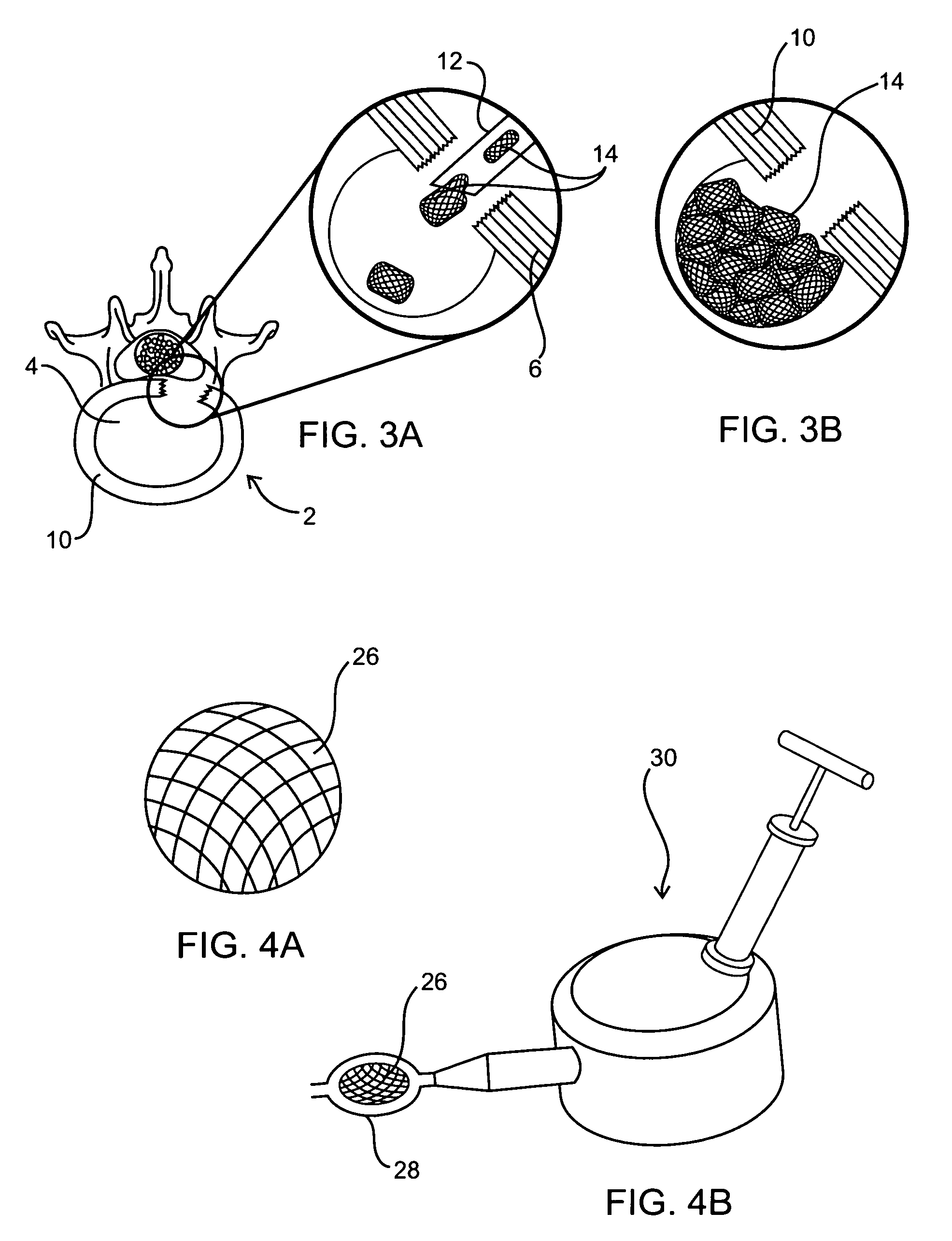 Fabrication and use of biocompatible materials for treating and repairing herniated spinal discs