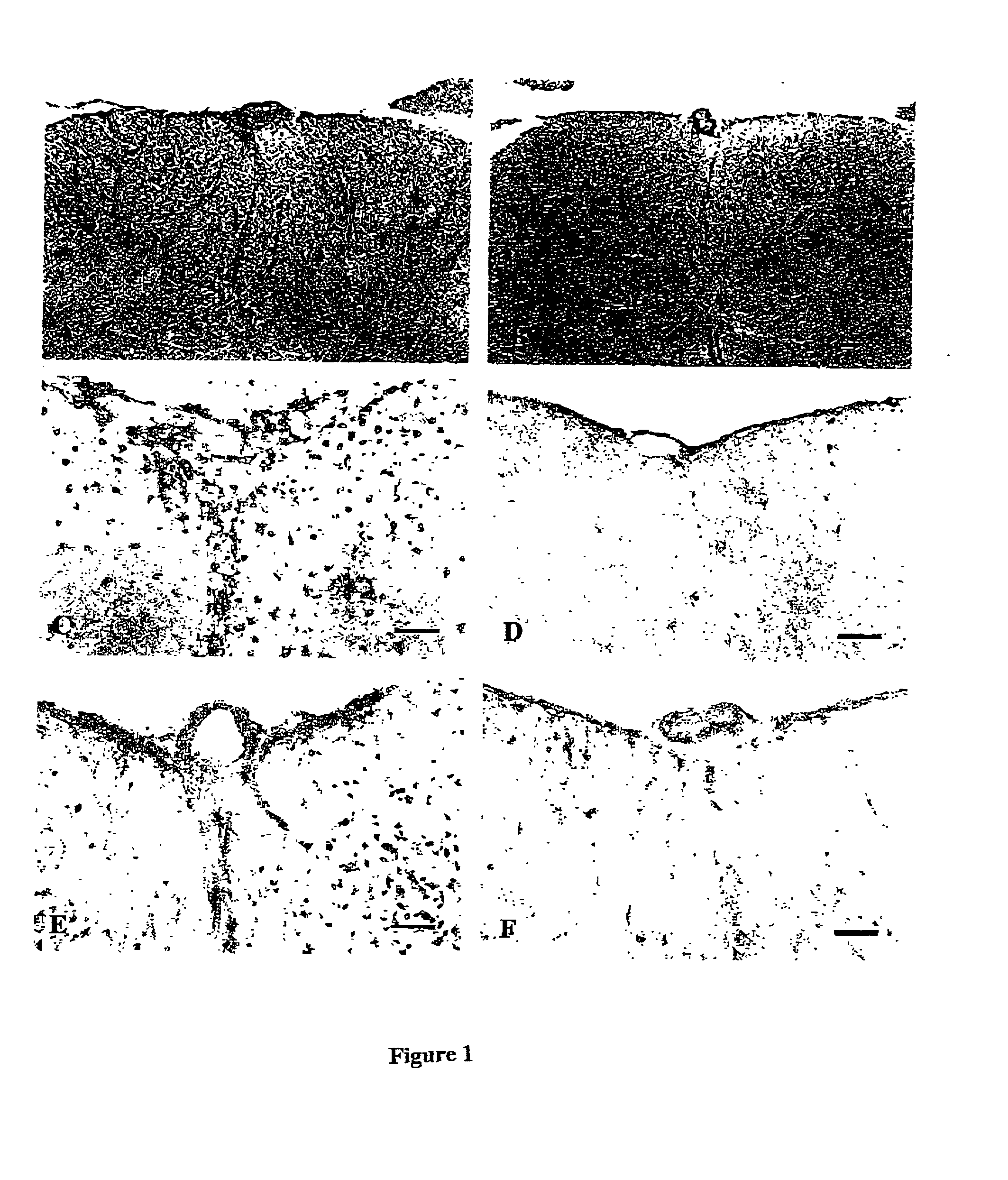 Method for inhibiting inflammation in immune privileged sites using Fas ligand fragments