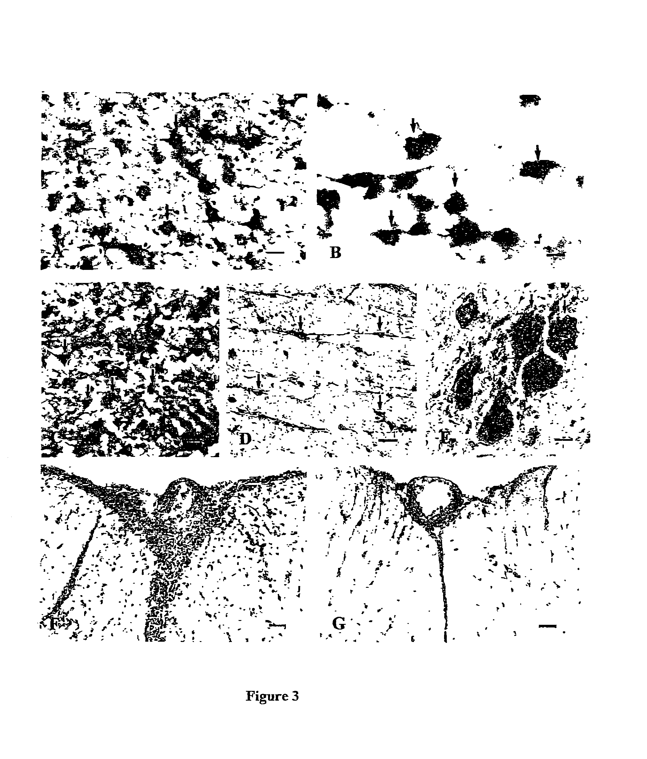 Method for inhibiting inflammation in immune privileged sites using Fas ligand fragments