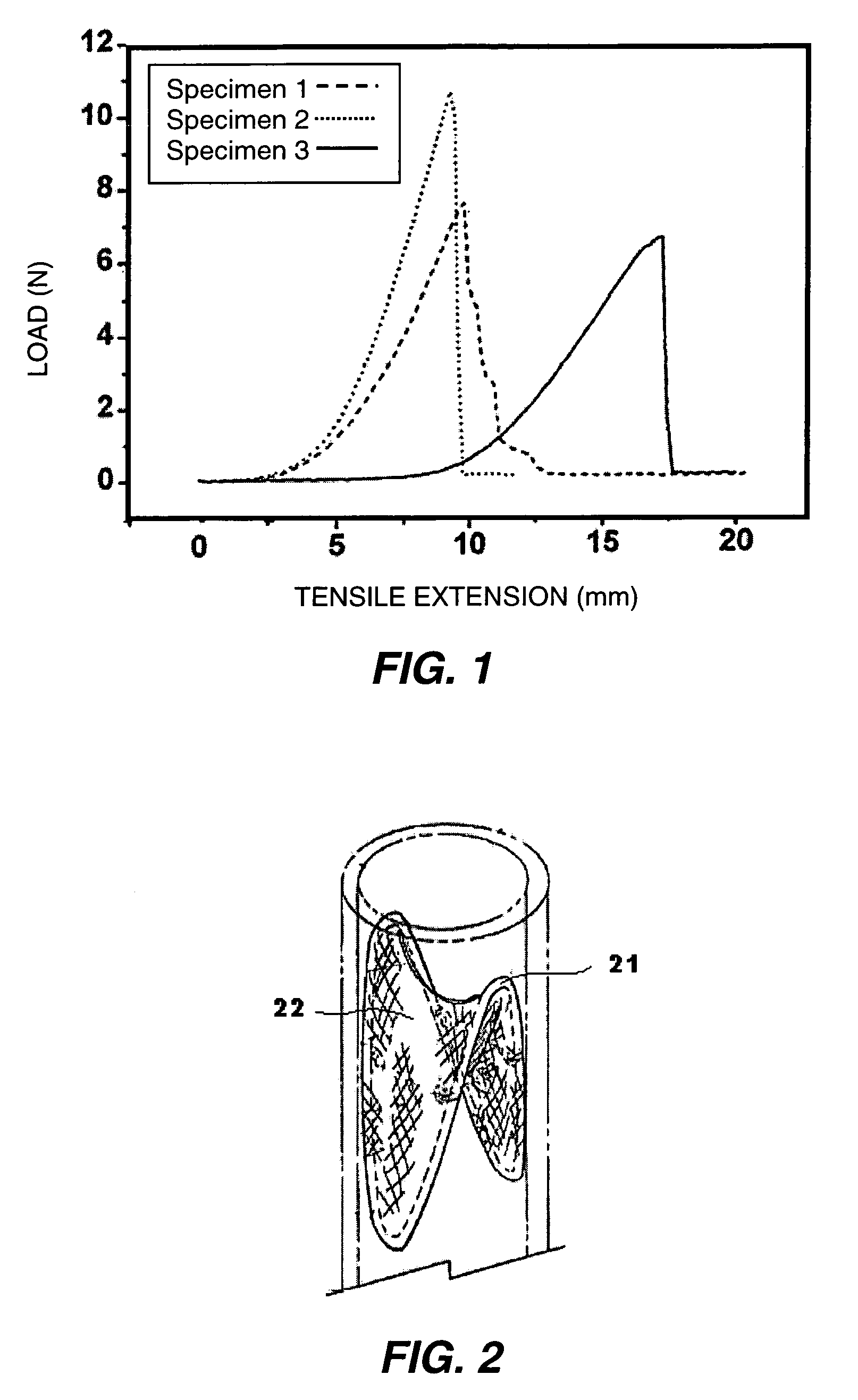 Graft prosthesis devices containing renal capsule collagen