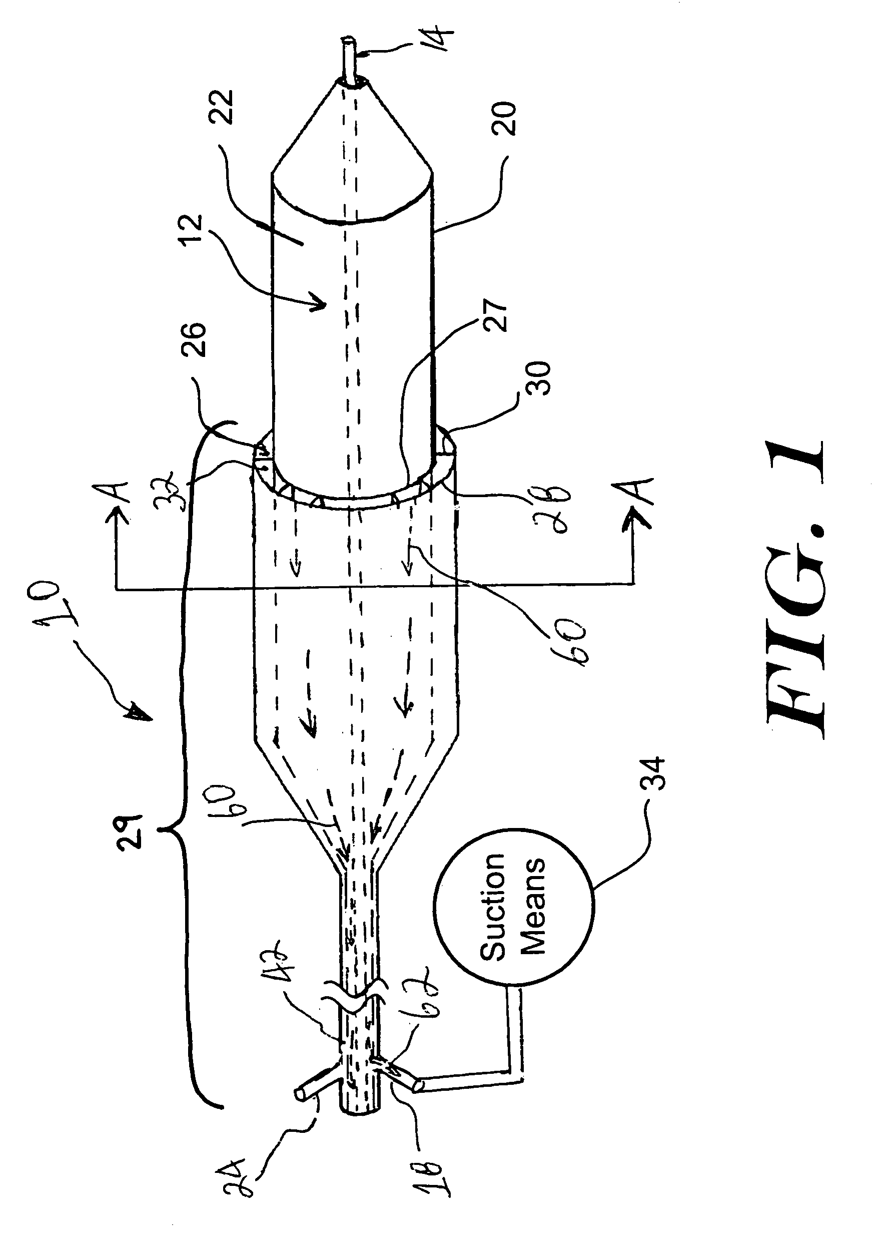 Aspirating balloon catheter for treating vulnerable plaque