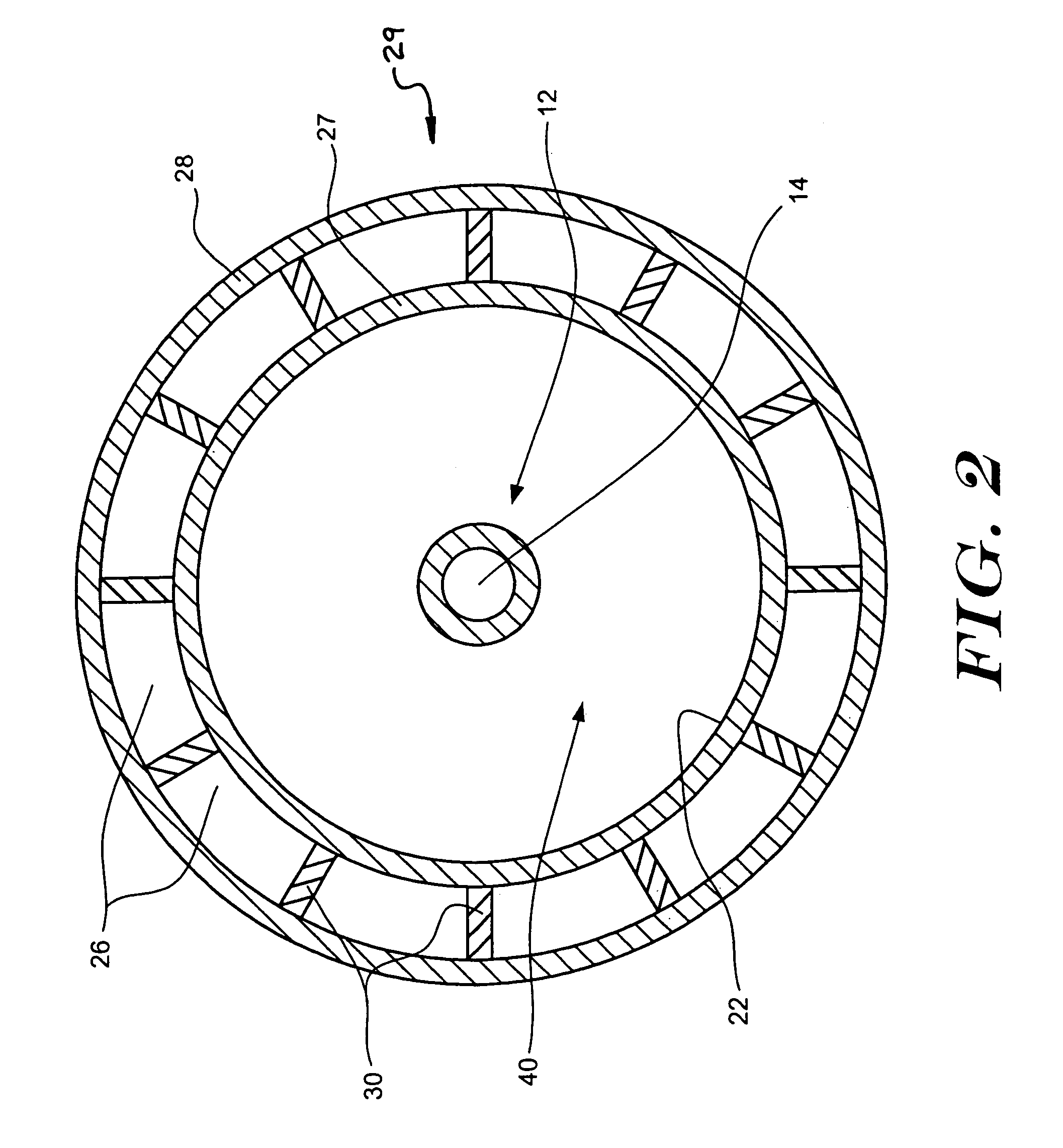 Aspirating balloon catheter for treating vulnerable plaque