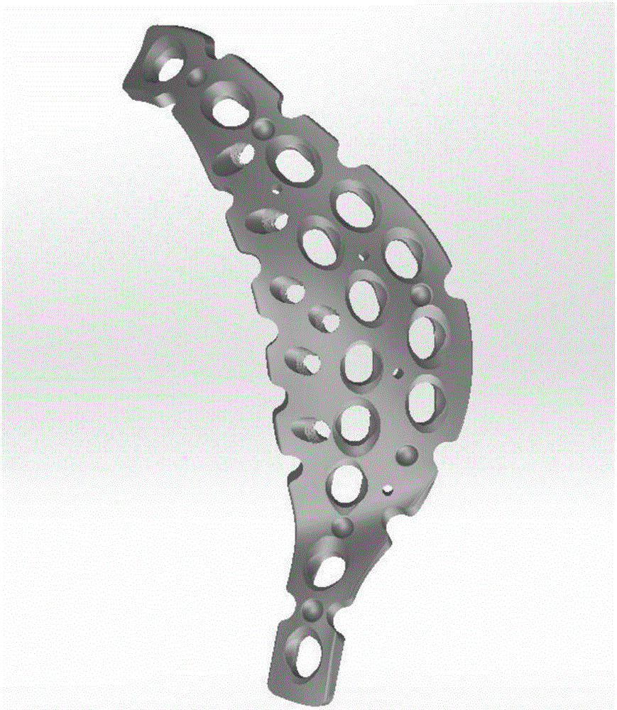 Method and apparatus for designing acetabulum back-wall back-column bone fracture internally fixing system