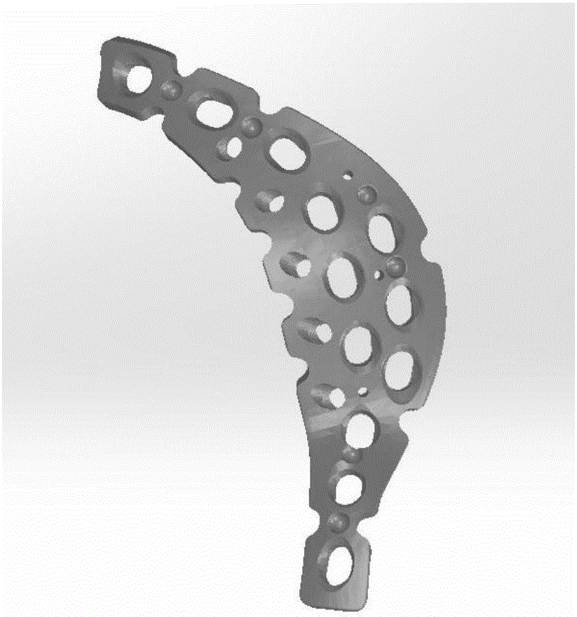 Method and apparatus for designing acetabulum back-wall back-column bone fracture internally fixing system