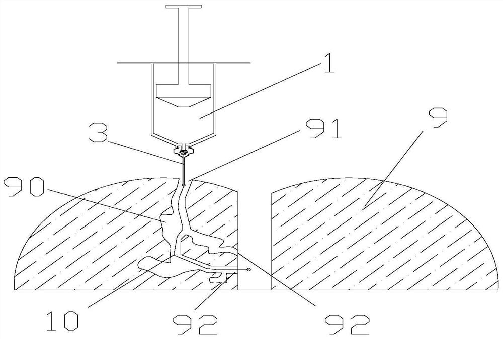 A strip tracing device suitable for anal fistula ducts