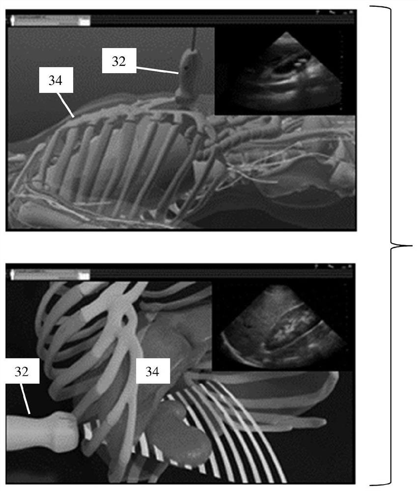 Region of interest positioning for longitudinal monitoring in quantitative ultrasound