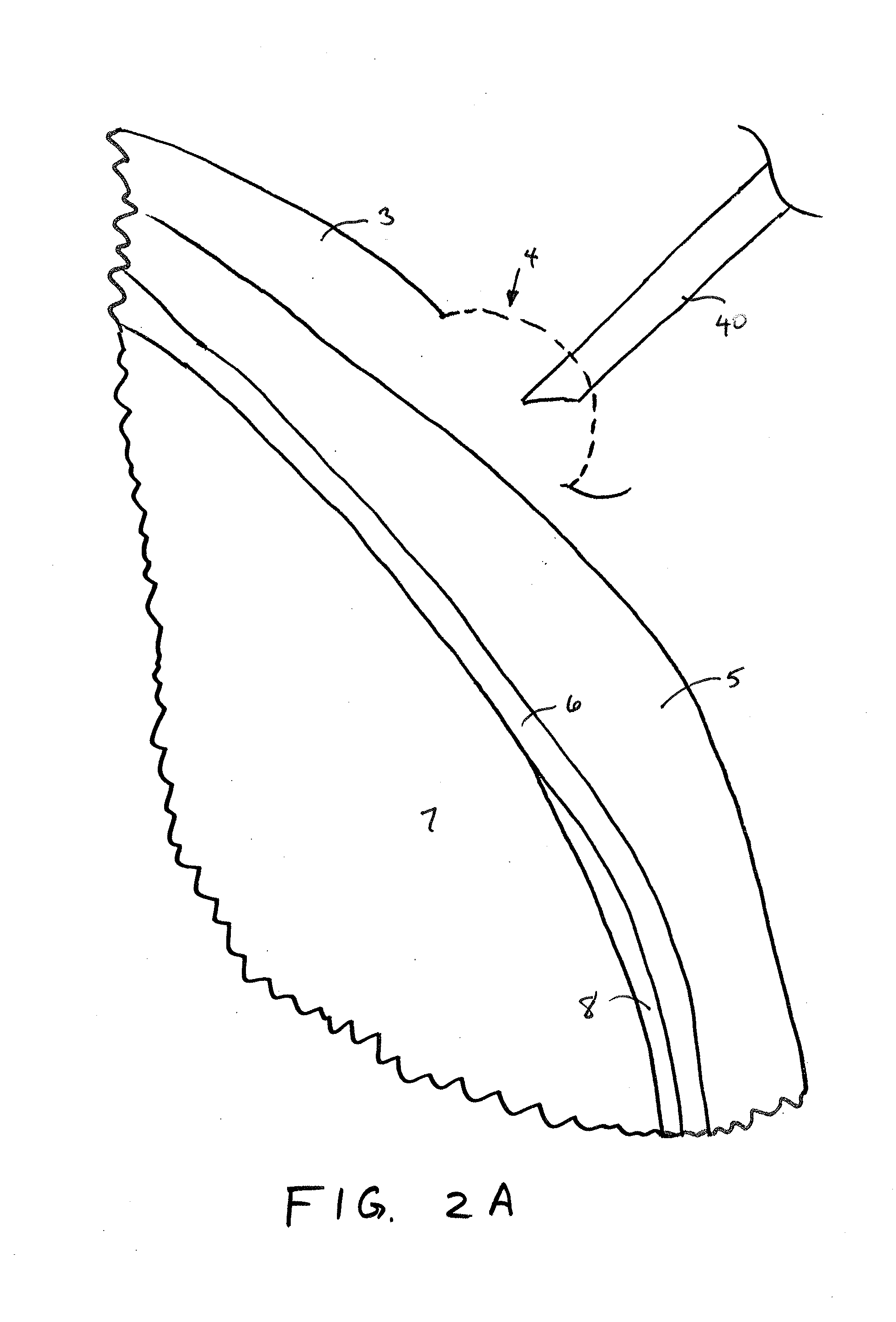 Methods and devices for implantation of intraocular pressure sensors