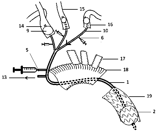 Perfusion flow guide device for avoiding deep hypothermic circulatory arrest in aortic total arch replacement