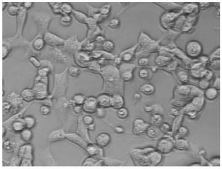 Vaccine for simultaneously preventing neospora and toxoplasma infection, preparation method and application thereof