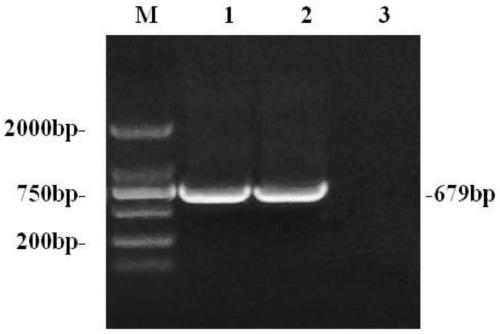 Vaccine for simultaneously preventing neospora and toxoplasma infection, preparation method and application thereof