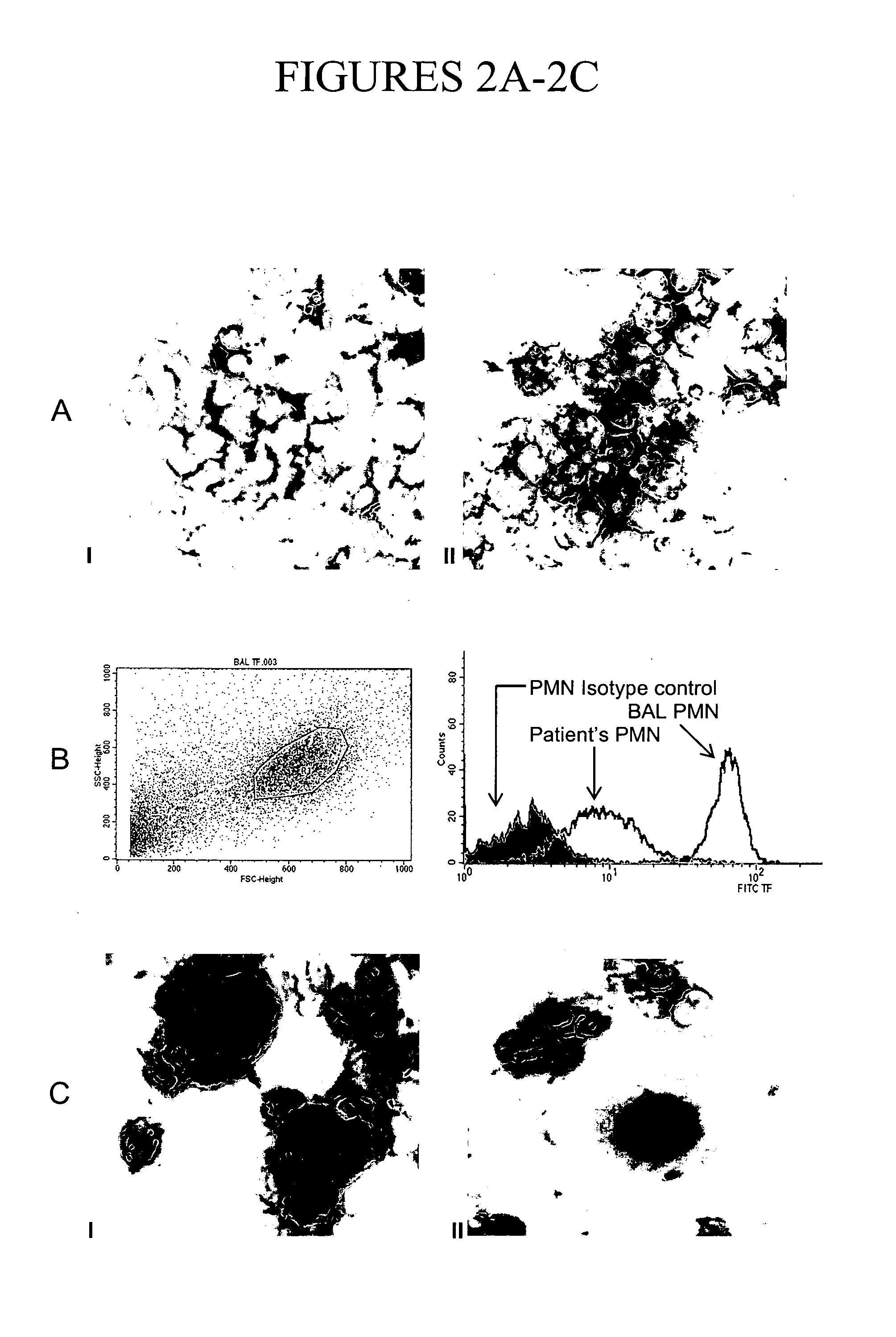 Method Of Treating Acute Respiratory Distress Syndrome