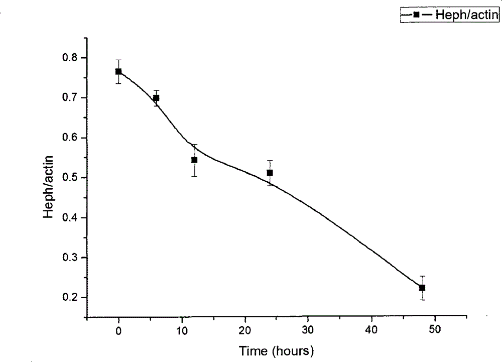 siRNA recombinant slow virus for inhibiting human hephaestin gene expression and application